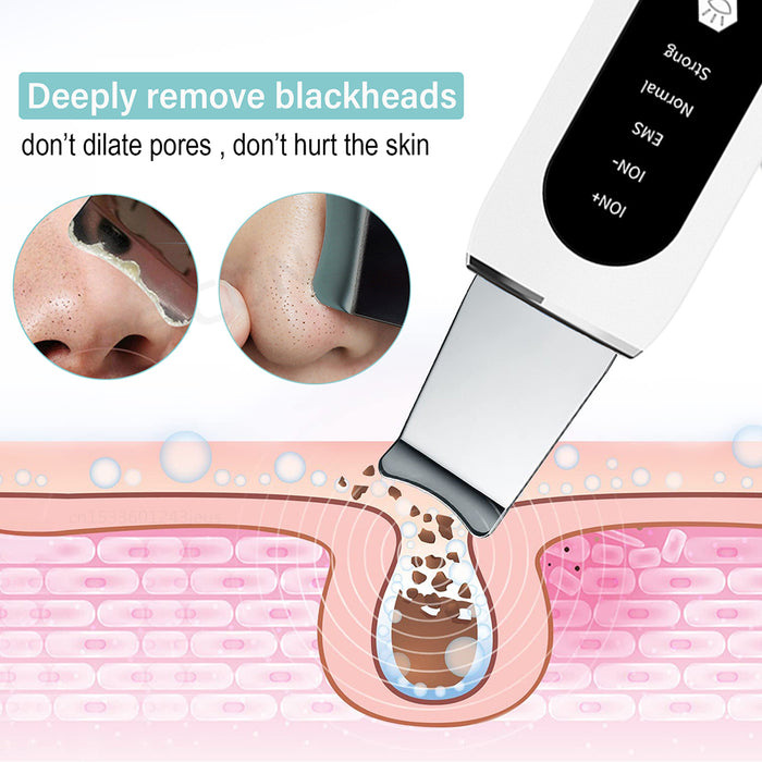 Épurateur de peau visage spatule dissolvant de points noirs nettoyage du visage outil de soins de beauté